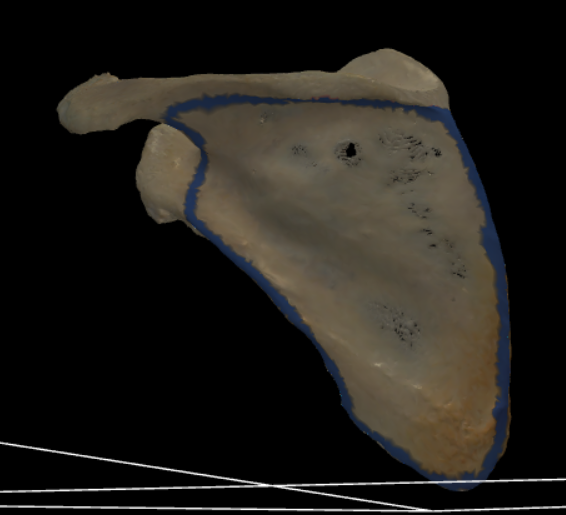 <p><span>gans het gebied onder de spina scapulae op de facies posterior</span></p>