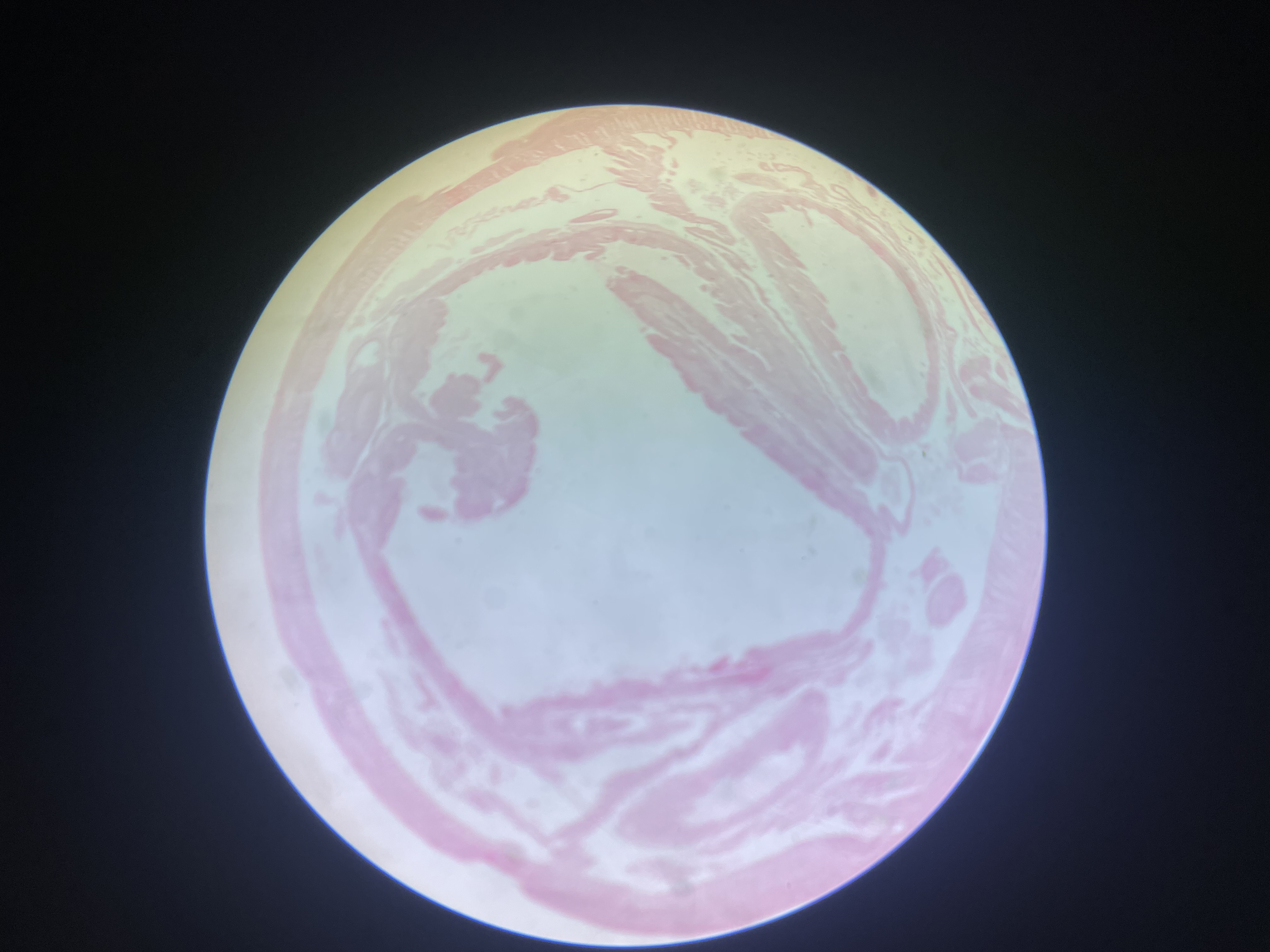 term image