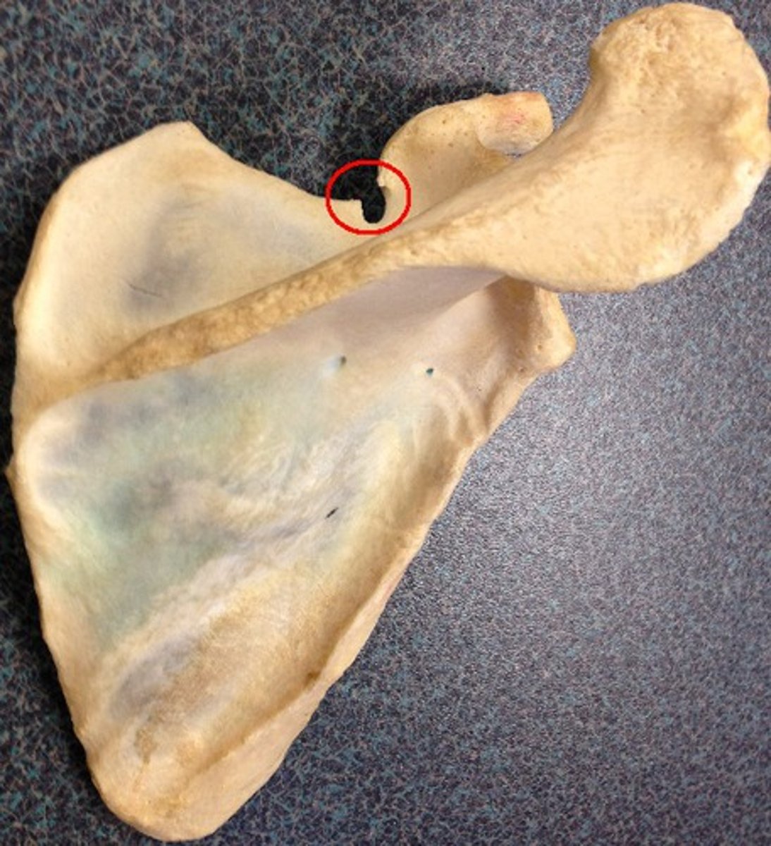 <p>Scapula - superior notch</p>