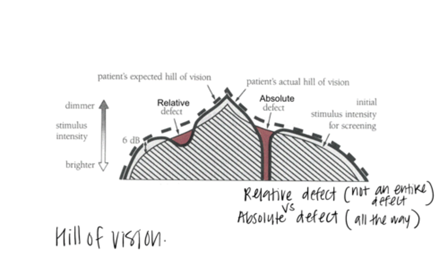 <p>What is a relative VF defect?</p>