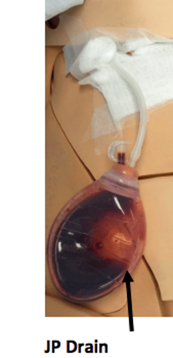 <p>drain inserted into body, soft collection canister where blood/fluid/drainage collect</p>