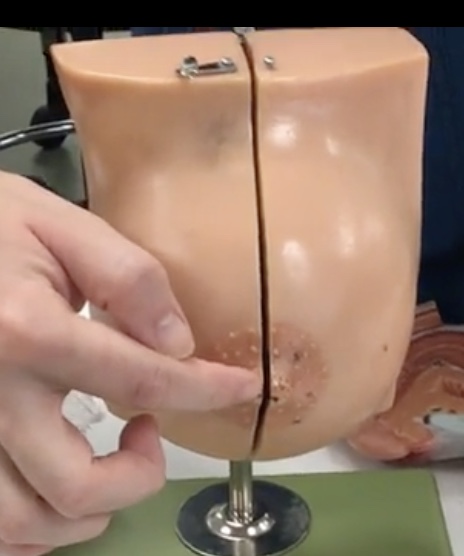 <p>Description: Elevation of skin at center of breast</p><p>Relationship: Contains smooth muscle</p>