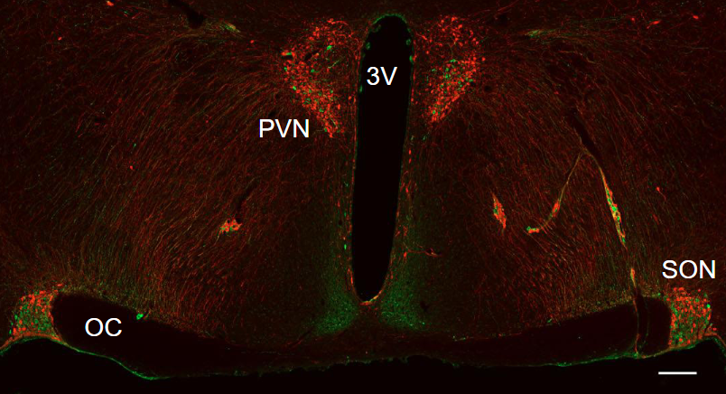 <p>In the PVN:</p><ul><li><p>Magnocellular: Lateral</p></li><li><p>Parvocellular: Medial</p></li></ul><p></p><p>In SON:</p><ul><li><p>Magnocellular</p></li></ul><p></p>