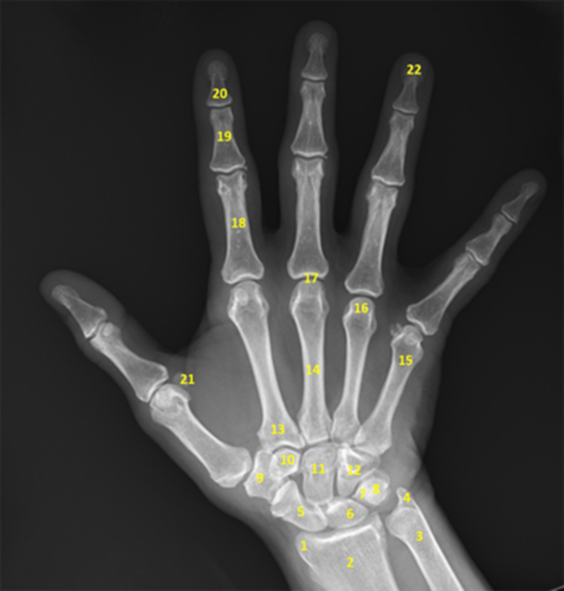 <p>A recorded image of an anatomic part acquired by the passage of x-ray through the body</p>