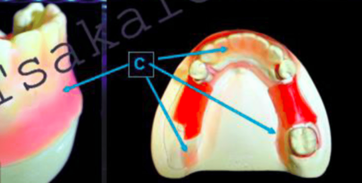 <p>ID the type of block out at C:</p>