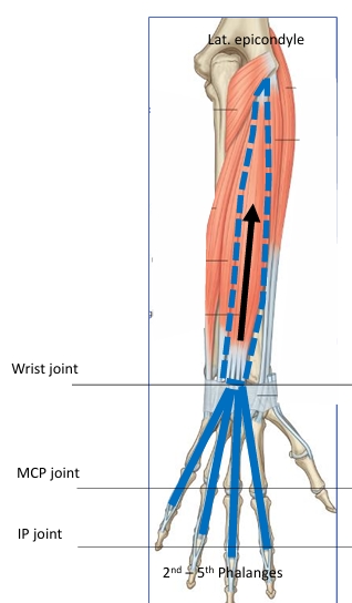 <p>Name this muscle</p>
