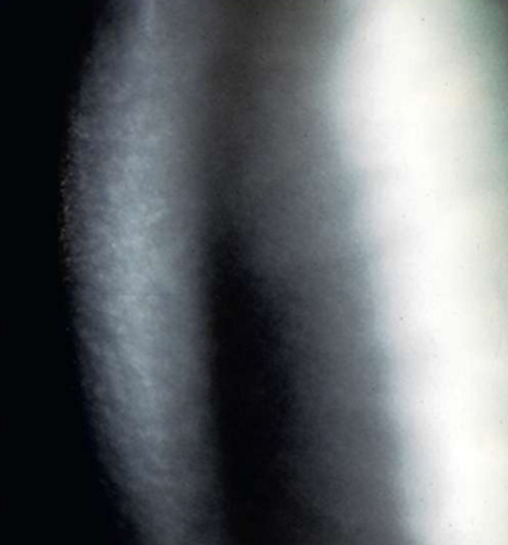 <p>What condition is this?</p>