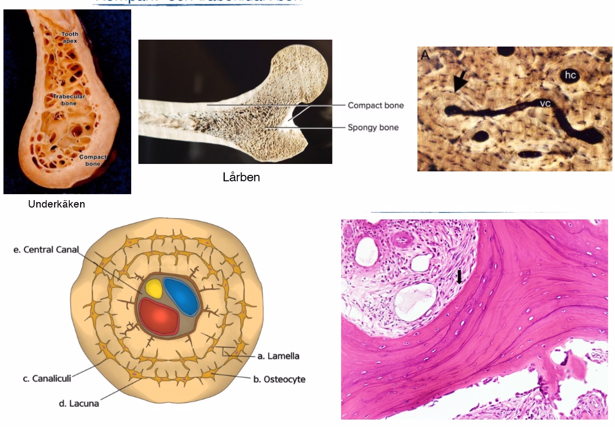 <p><strong>Kompakt(kortikalt)</strong></p><ul><li><p><span>utgör cirka 80% av den totala benvikten </span></p></li><li><p><span>Består av cirkulära benlager(lameller)</span></p></li><li><p><span>Cirkulära enheter=Haverska systemet(osteoner), bildas runt en central kanal(haversk kanal)- innehåller blodkärl och nerver</span></p></li><li><p><span>Främst mekaniska och skyddande</span><br><span>funktioner</span></p></li><li><p><span>Volkmanns kanaler/innehåller blodkärl och nerver) kopplar samman osteoner med varandra</span></p></li></ul><p><strong>Trabekulärt ben(spongiöst)</strong></p><ul><li><p>Paralella lameller</p></li><li><p><span>Den metaboliska funktionen ligger</span><br><span>främst hos det trabekulära benet</span></p></li></ul><p></p>