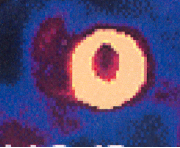 <p>What view of the heart is represented in this image?</p>