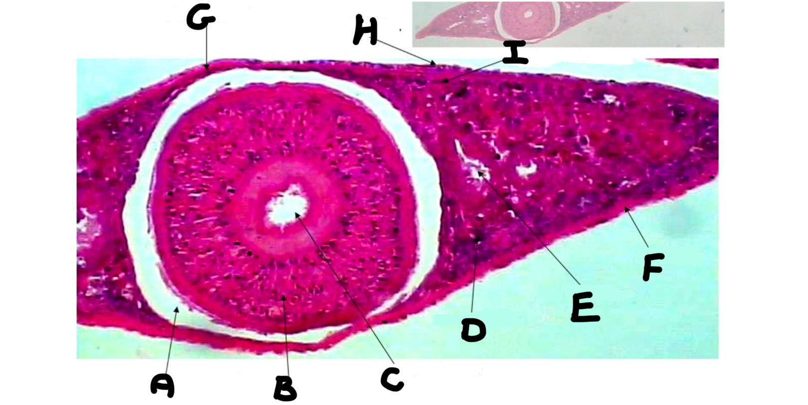 <p>What part of the planaria is labeled C</p>