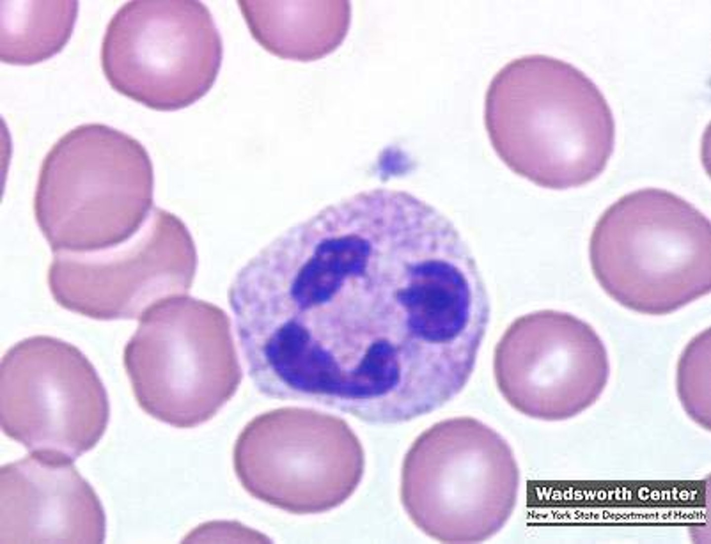<p>Nucleus: 2-5 lobes</p><p>• Granules: Fine and violet in color,</p><p>they take up both, basic and acidic stains</p>