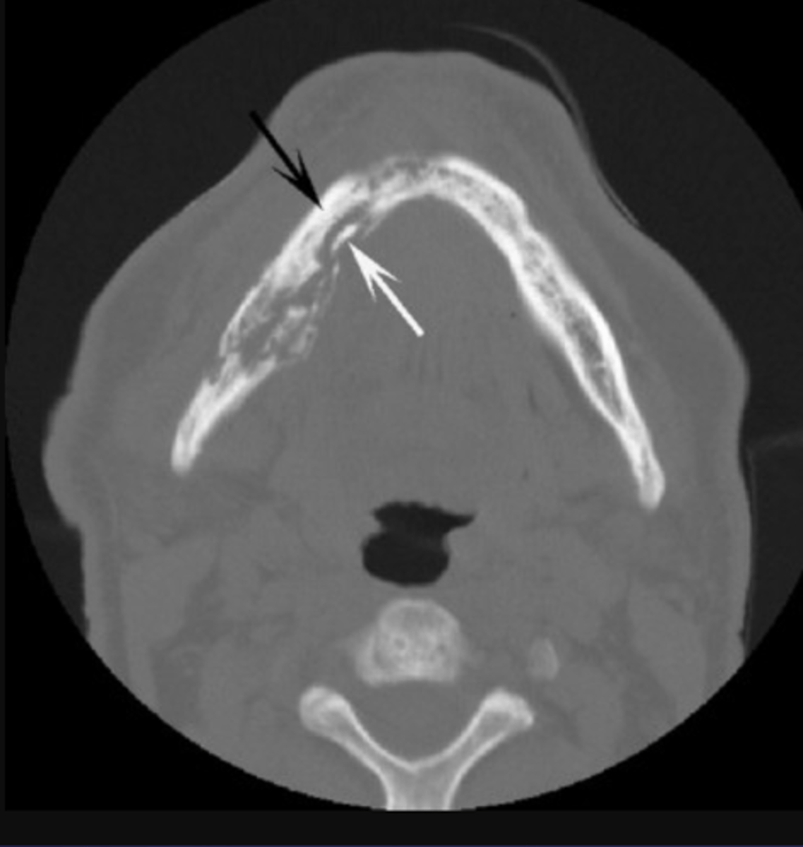 <p>What is the black arrow pointing at?</p>