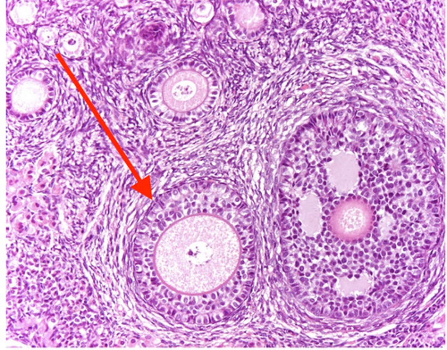 <p>what type of follicle?</p>