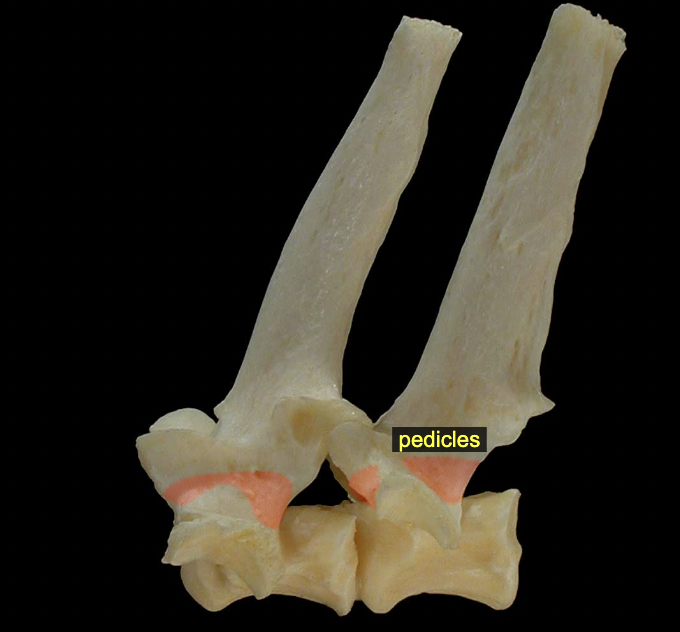 <p>Vertebral arch: Pedicles</p>