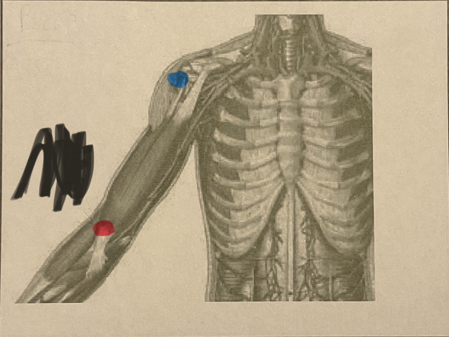 <p>Where is the insertion?</p>