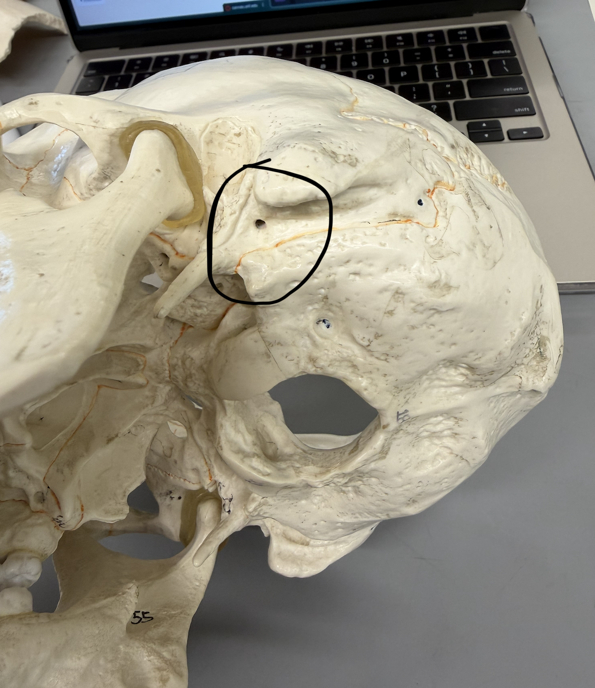 <p>hole between styloid process &amp; mastoid processes</p>