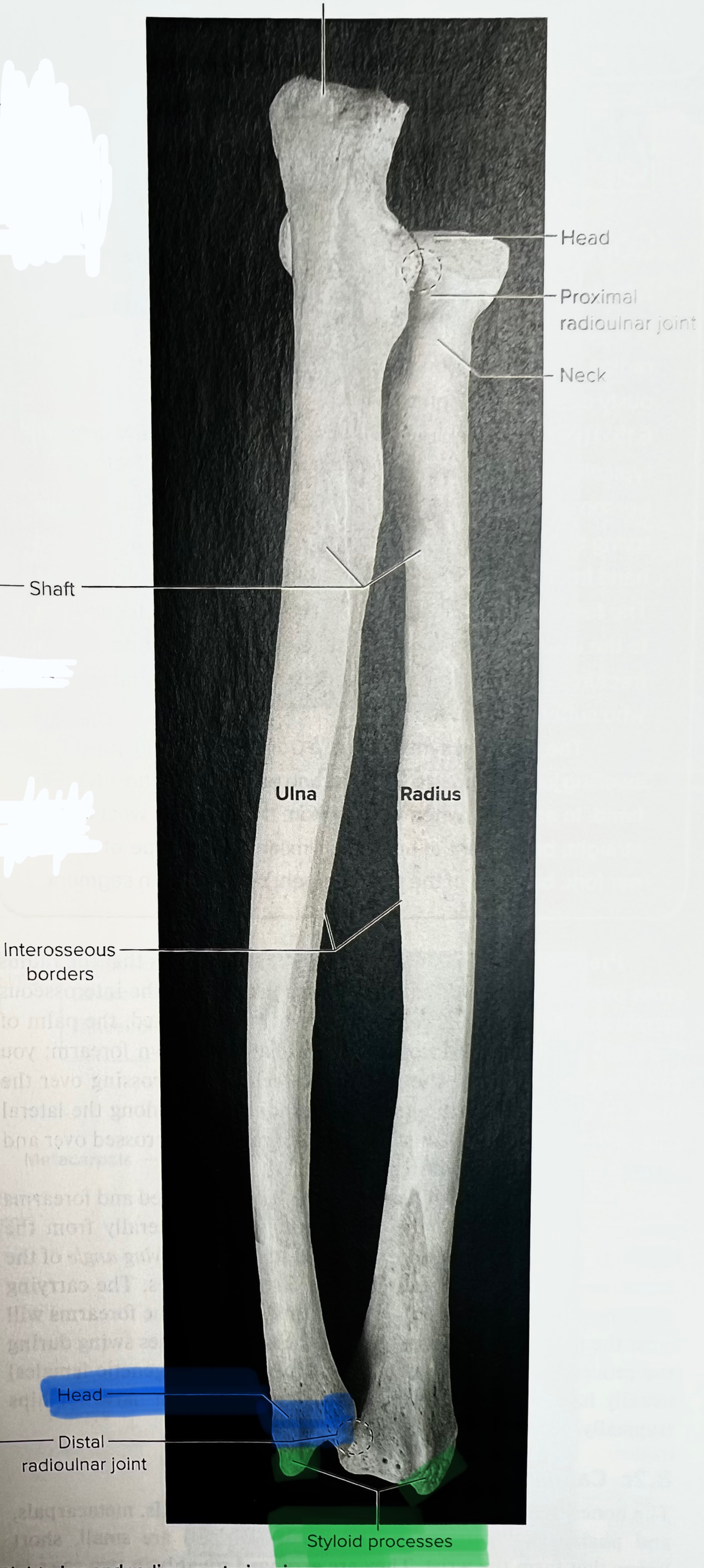 <p>distal</p><p>disc shaped</p>