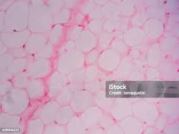 <p>light pink tiny veins/beehive</p>