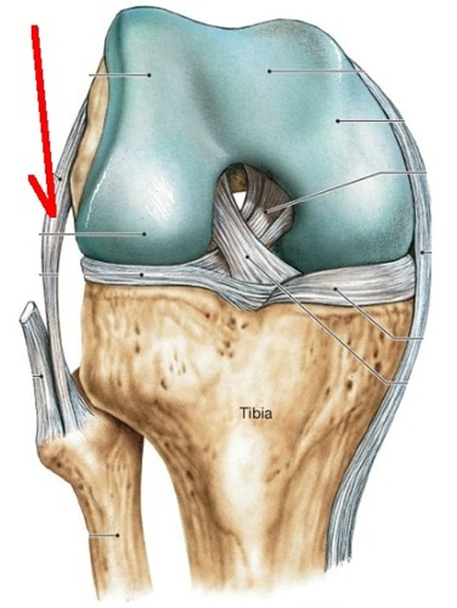 <p>- ligament running from the lateral epicondyle of the femur to the head of the fibula</p><p>- cord-like extracapsular ligament</p>