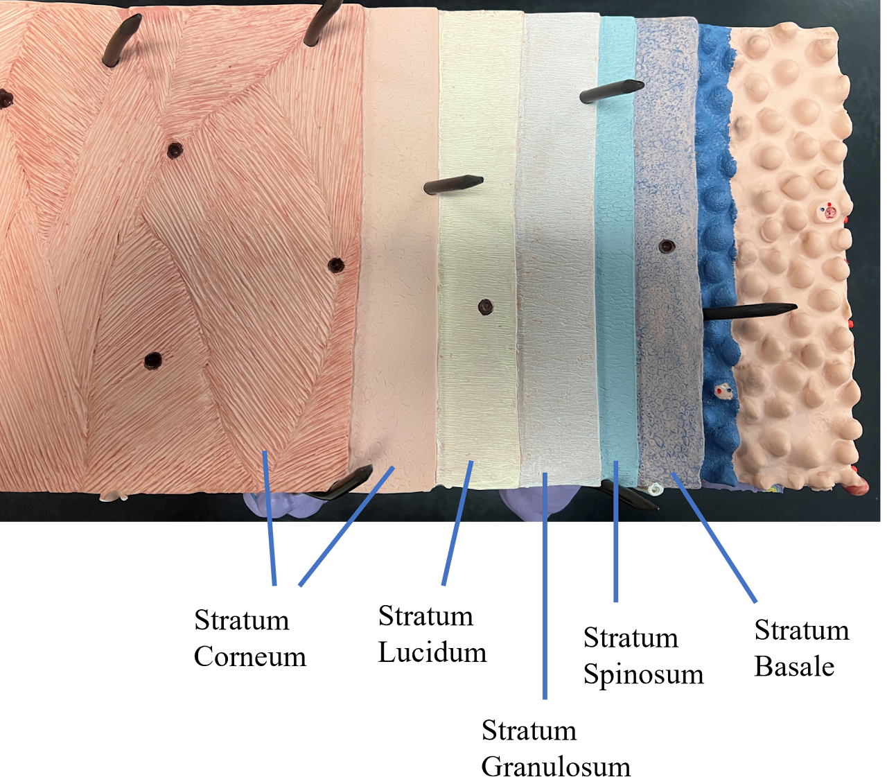 <p><span>very thick layer of dead cells</span></p>
