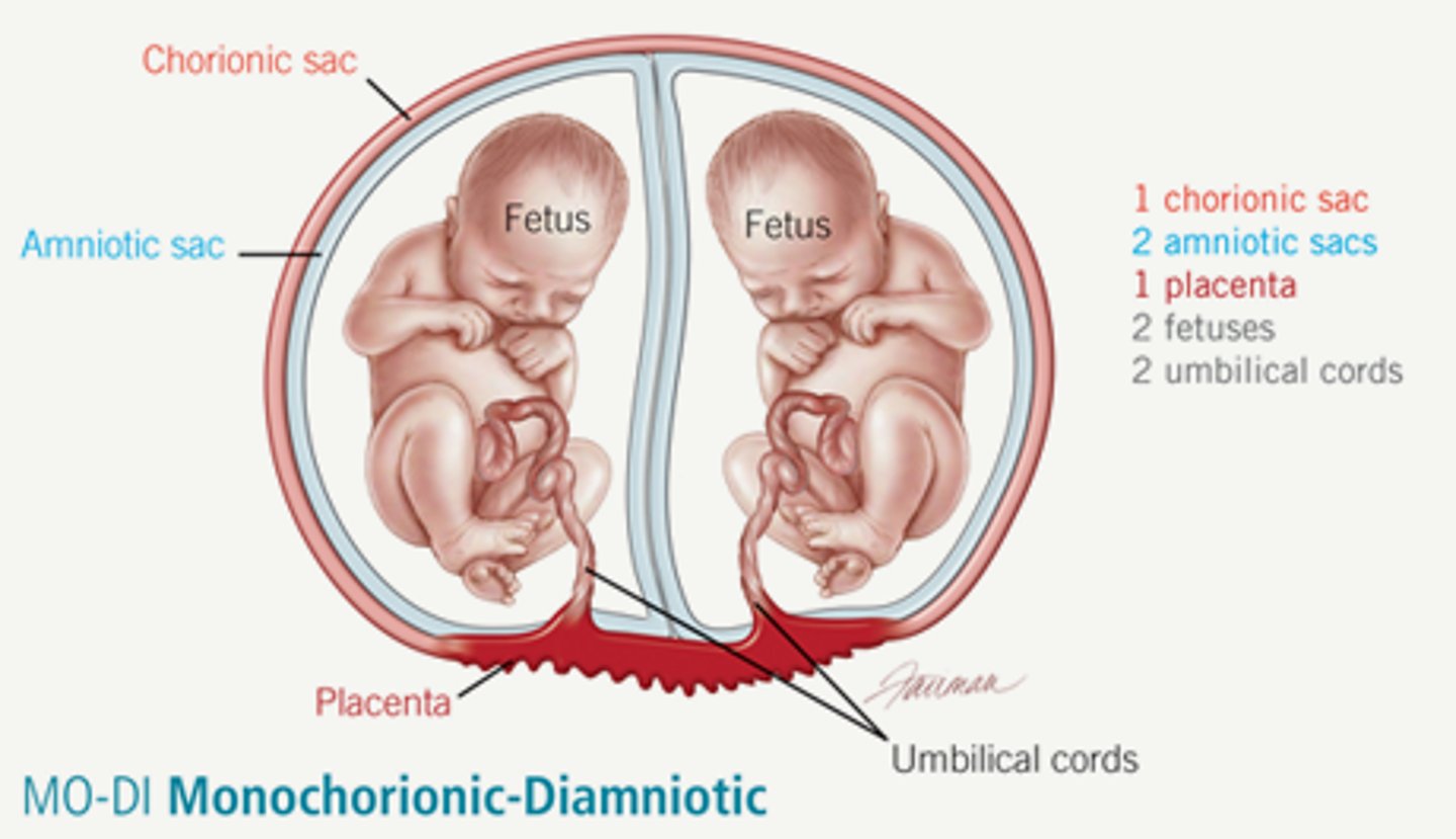<p>Twins that share the same placenta.</p>