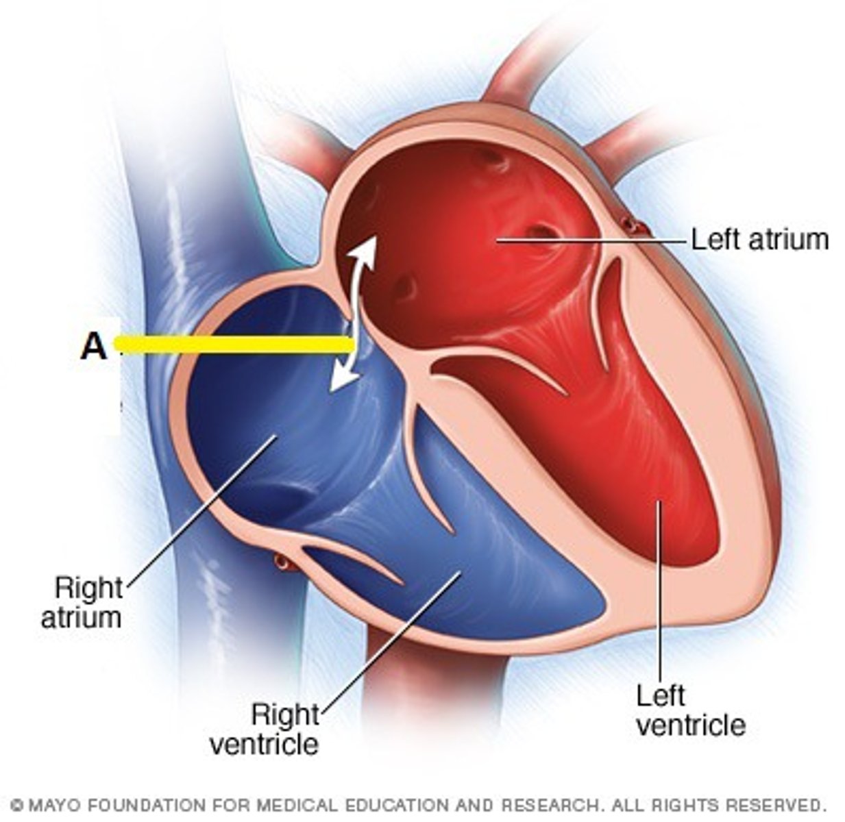 <p>connects the two atria in the fetal heart</p>