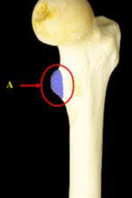 <p>medial, proximal femur</p>