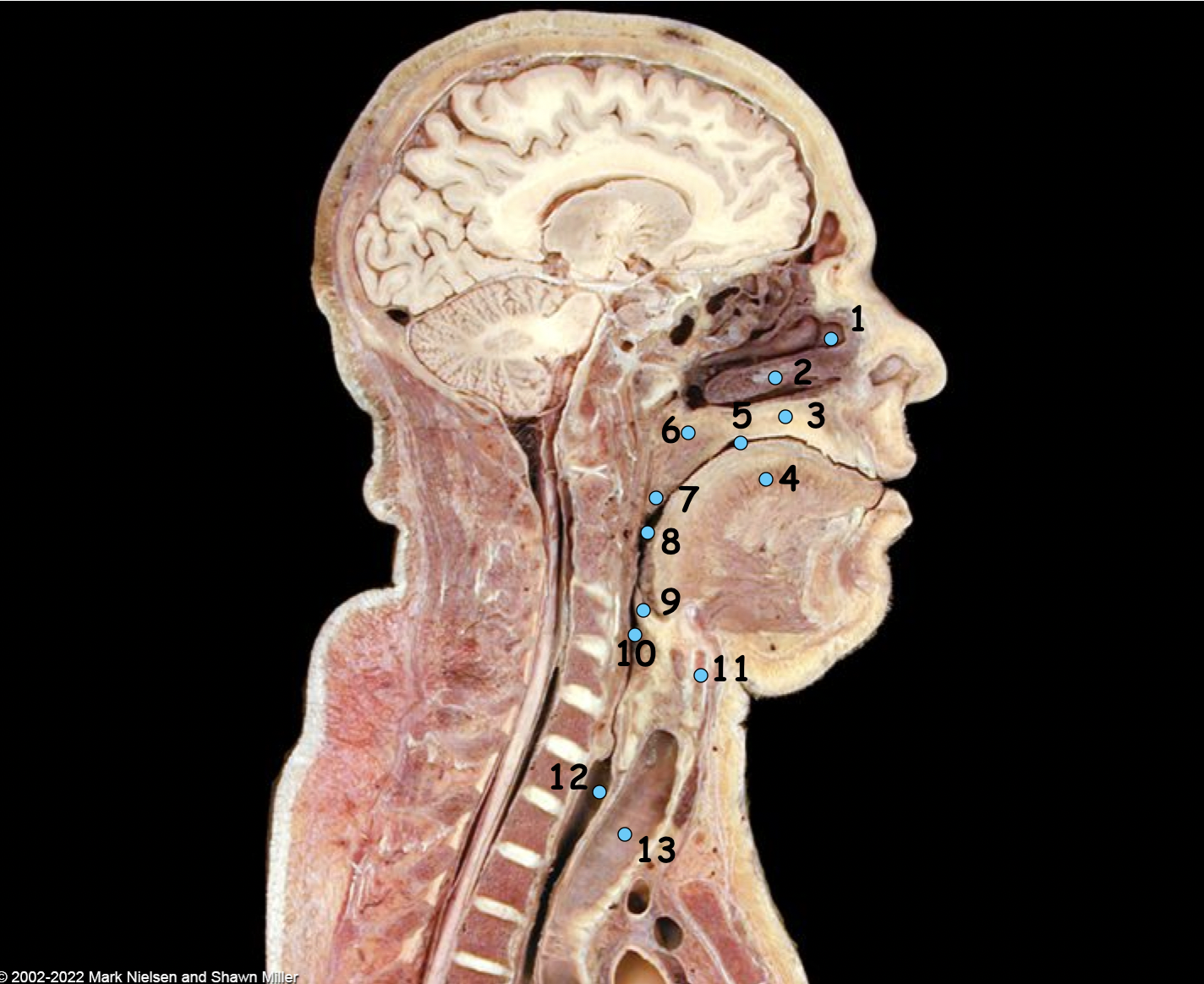 <p>What is number 6</p>