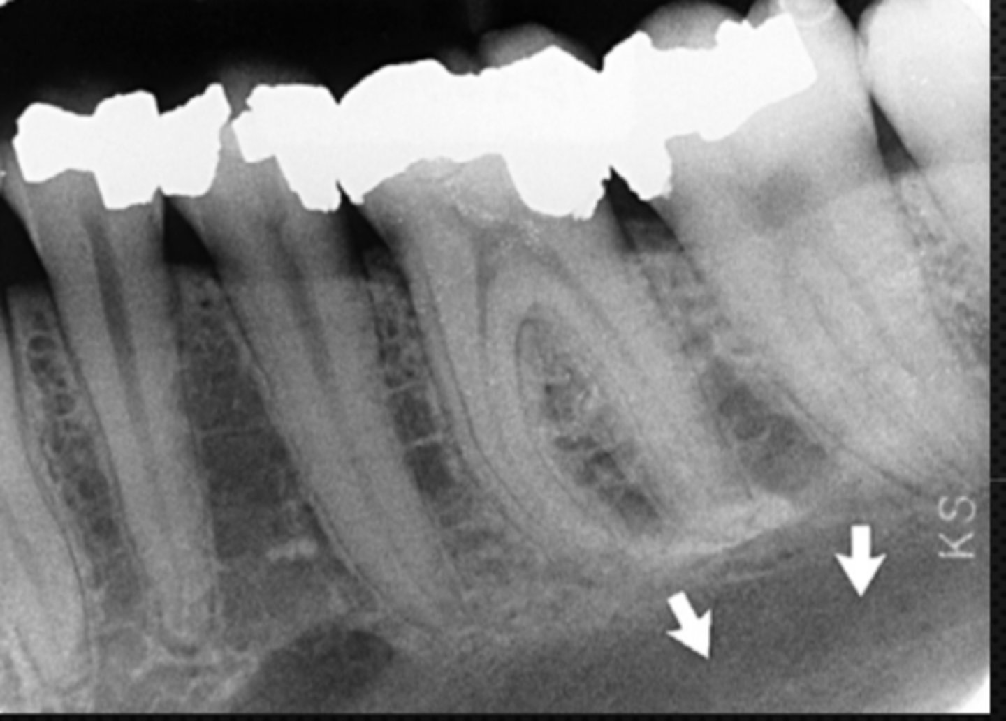 <p>Identify the large radiolucent area</p>