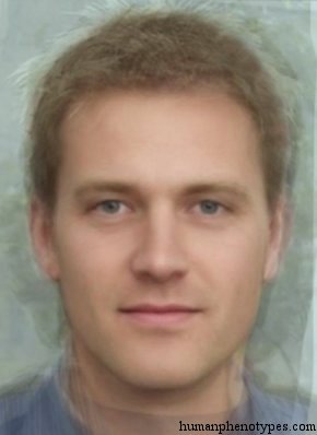 <p>Identify this Phenotype</p>