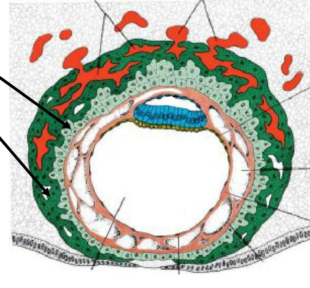 <p>الاسهم اللي فوق واللي تحت مش معانا </p><p>الاتنين اللي في كل جمب وال 2 cavities</p>