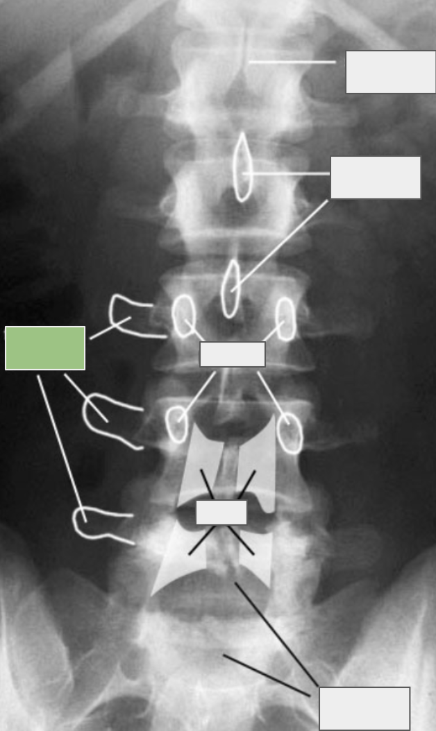 <p>What is referenced by the box highlighted in green?</p>