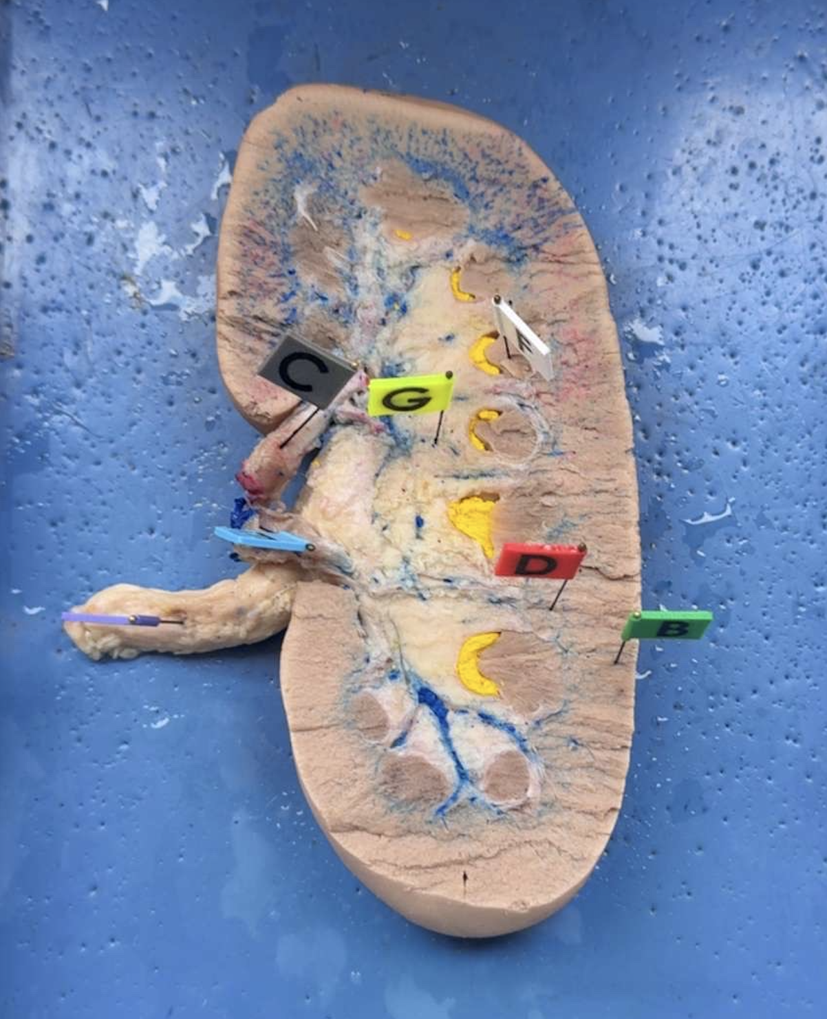 <p>name the parts of the kidney</p>