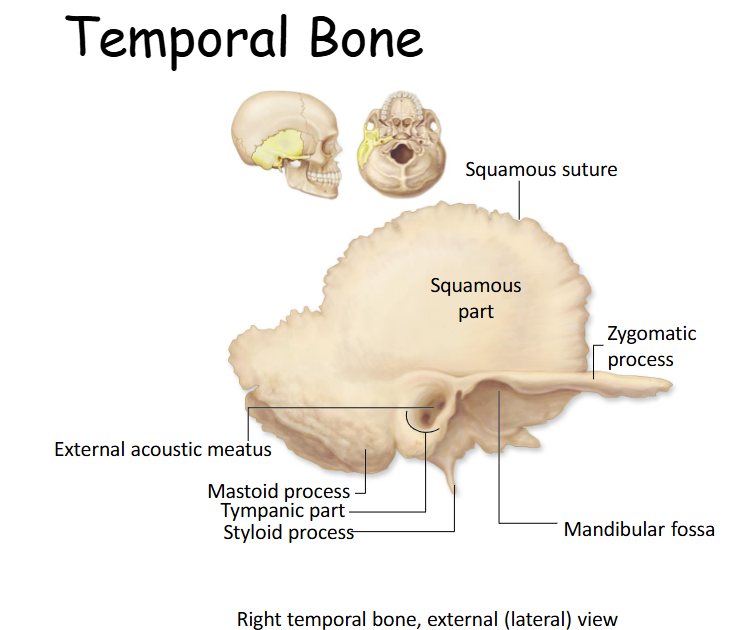 <p>Inferiolateral wall of the skull with parts: Petrous, squamous, mastoid and tympanic. </p>