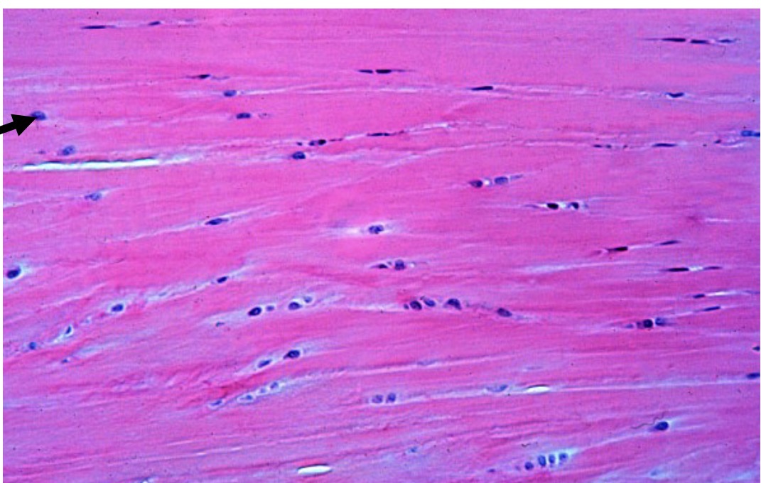 <p>Identify the type of tissue and the<br>structure at the arrow</p>