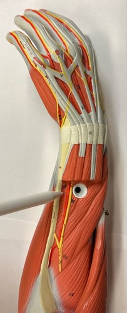 <p>What are the (2) attachments of the Extensor Indicis?</p>