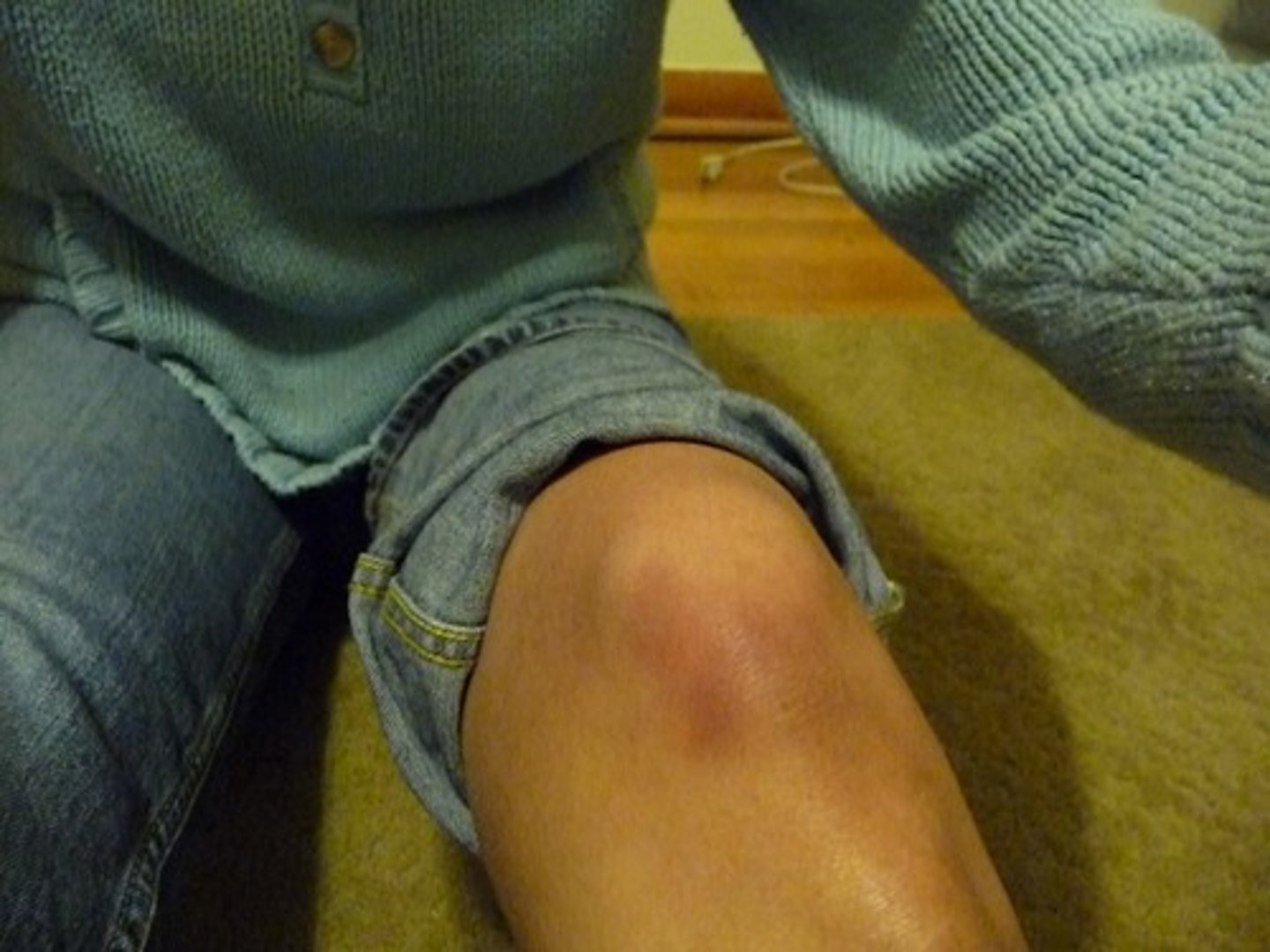 <p>knee</p>