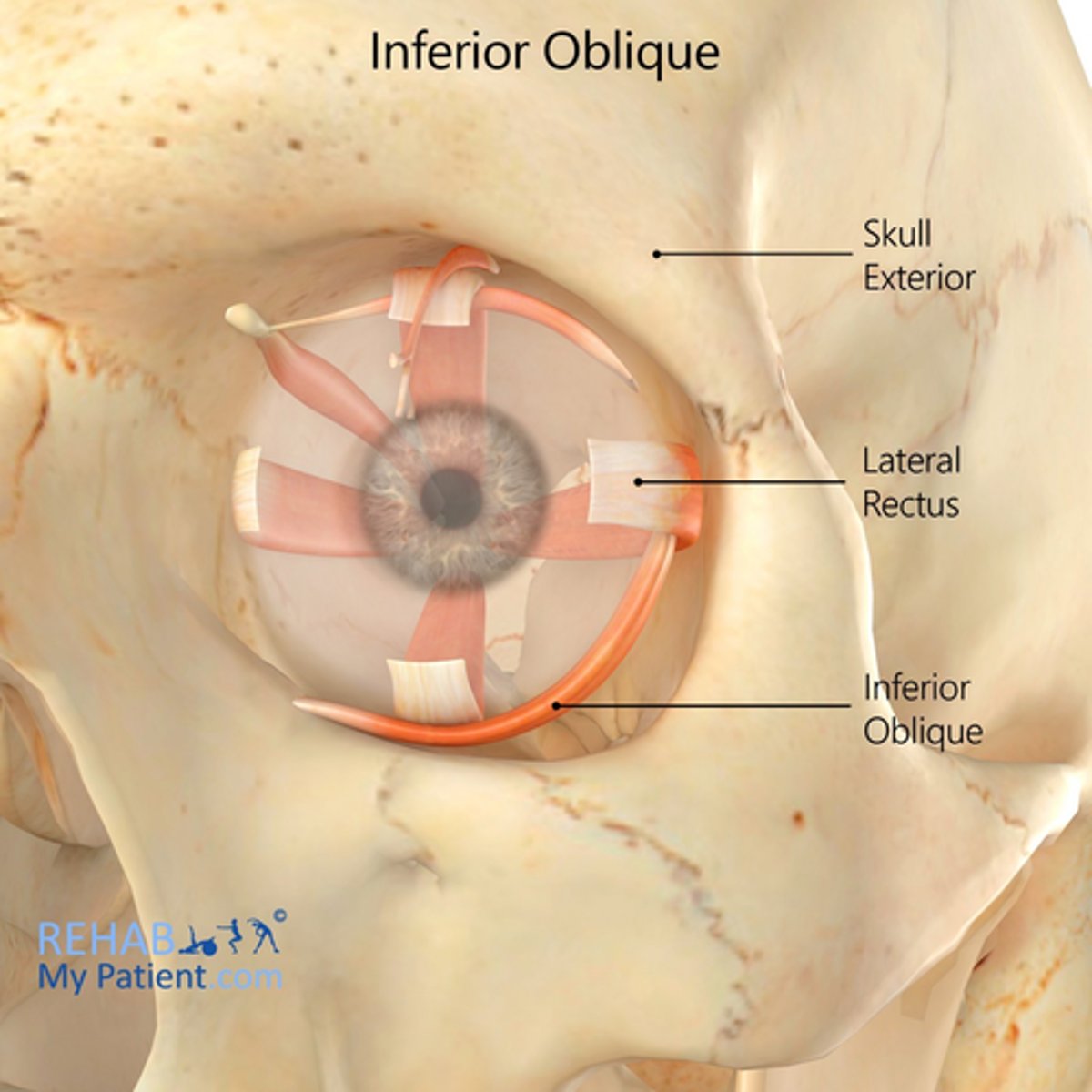 <p>anterior floor of the orbit (near lacrimal fossa)</p>