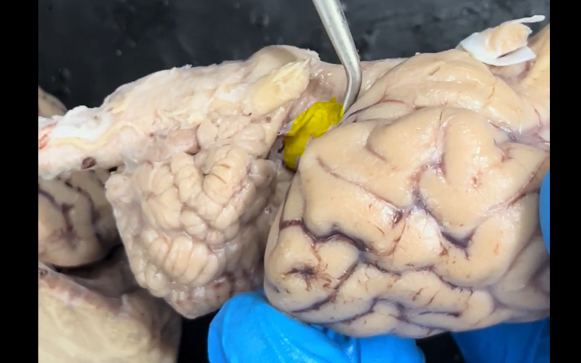 <p>Name the part of the brain that is highlighted in yellow.</p>