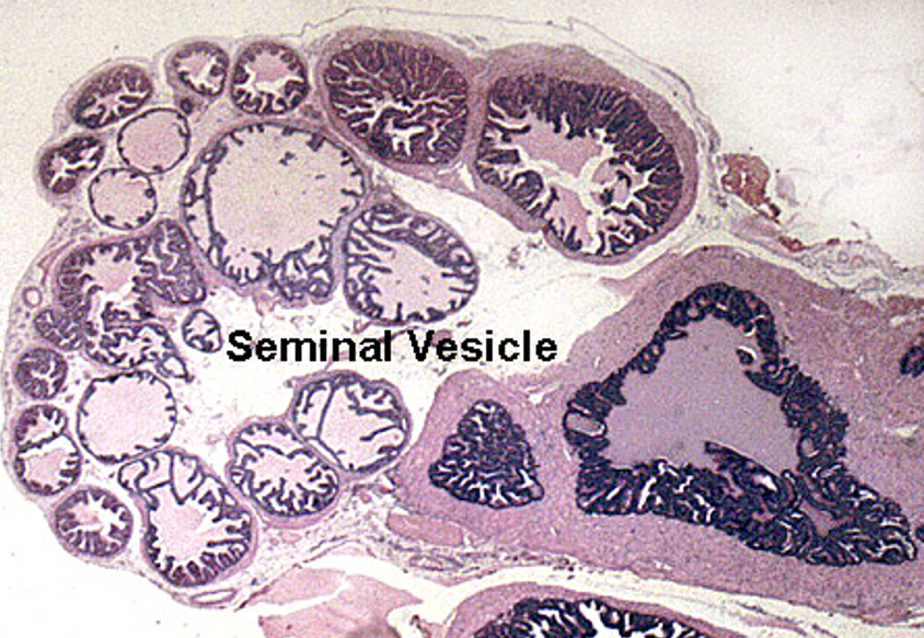 <p>Seminal vesicle</p><ul><li><p class=""><strong>Highly folded mucosa</strong>, giving a <strong>honeycomb</strong> or <strong>maze-like</strong> appearance</p></li><li><p class="">Lined by <strong>pseudostratified columnar epithelium</strong> with <strong>secretory cells</strong></p></li><li><p class=""><strong>No sperm</strong> in the lumen</p></li><li><p class="">Thin <strong>smooth muscle layers</strong>: inner circular, outer longitudinal</p></li><li><p class="">Lumen often contains <strong>eosinophilic secretion</strong></p></li></ul><p></p>
