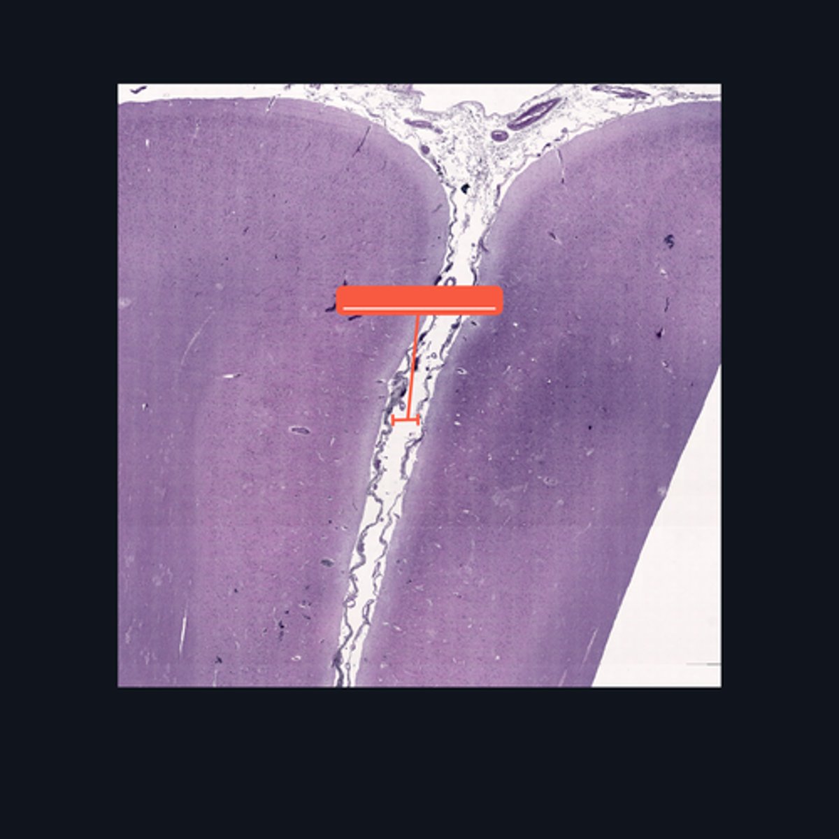 <p>Outer surface of cerebral hemisphere is highly folded to form convolutions known as</p>