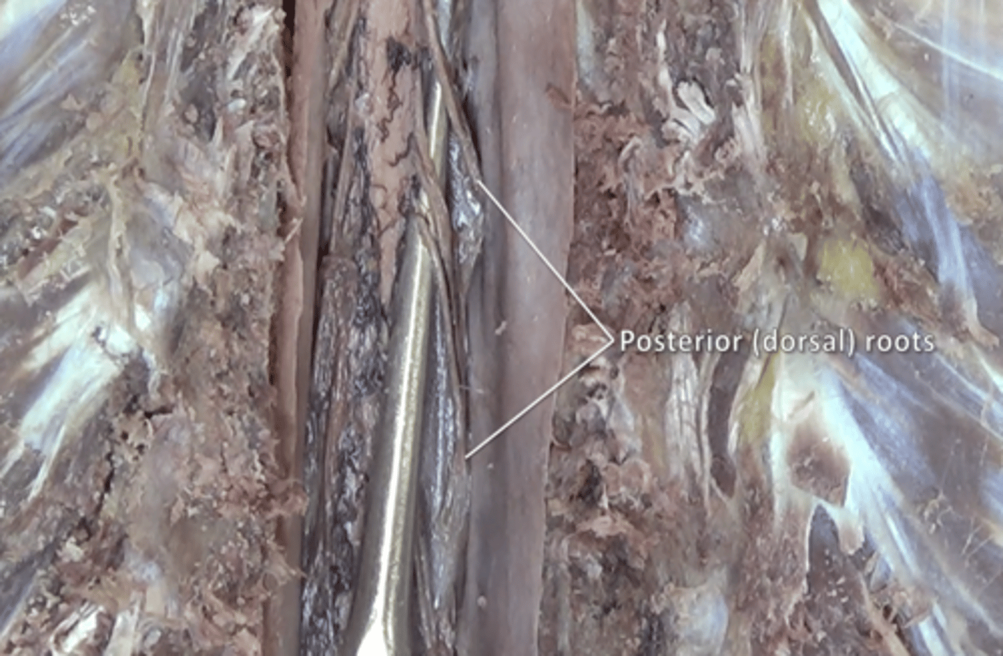 <p>fibers carry sensory information located posteriorly to denticulate ligaments</p>