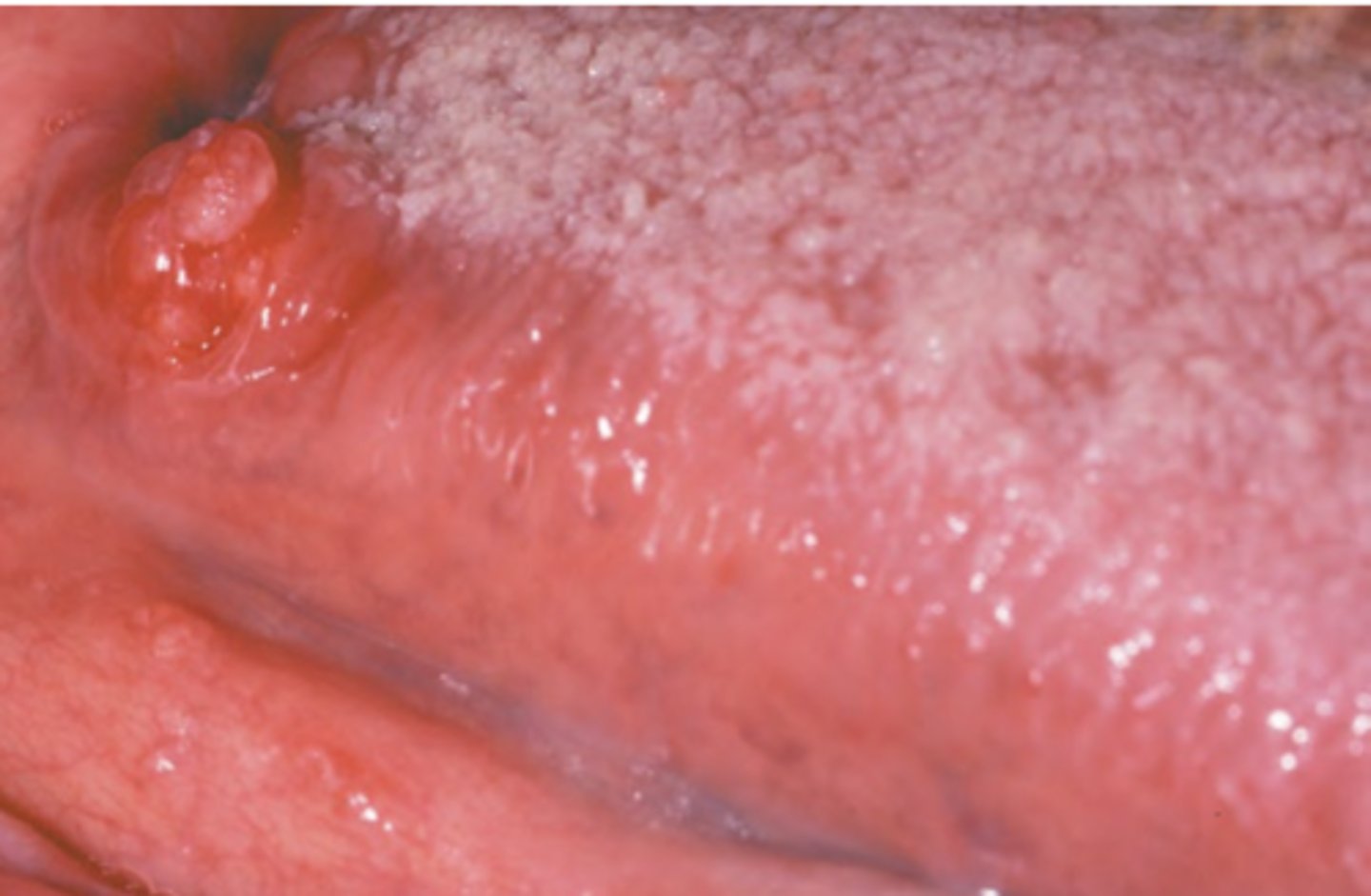 <p>Hint: Varied clinical presentation</p>