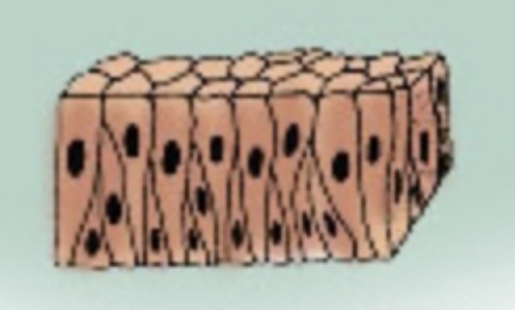 <p>What type of epithelium is this?</p>