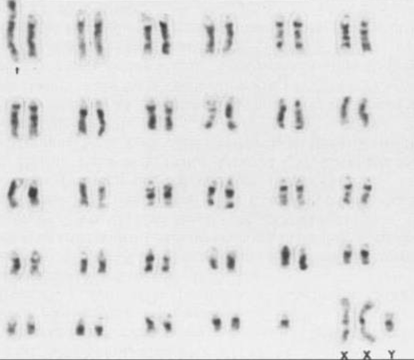 <p>Describe this <span style="color: green"><strong>karyotype</strong></span><strong> </strong></p>