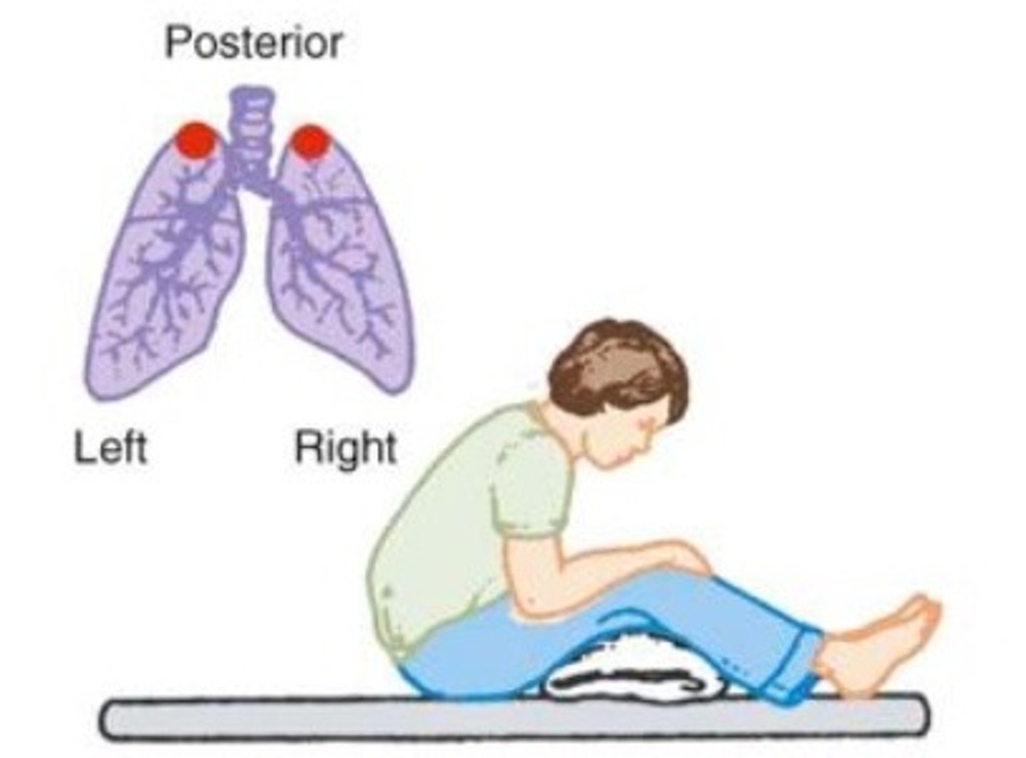 <p>- Position the patient sitting and leaning forward at about a 45 degree angle.</p><p>- Area to percuss is just above the scapula with the fingers extending up onto the shoulders.</p>