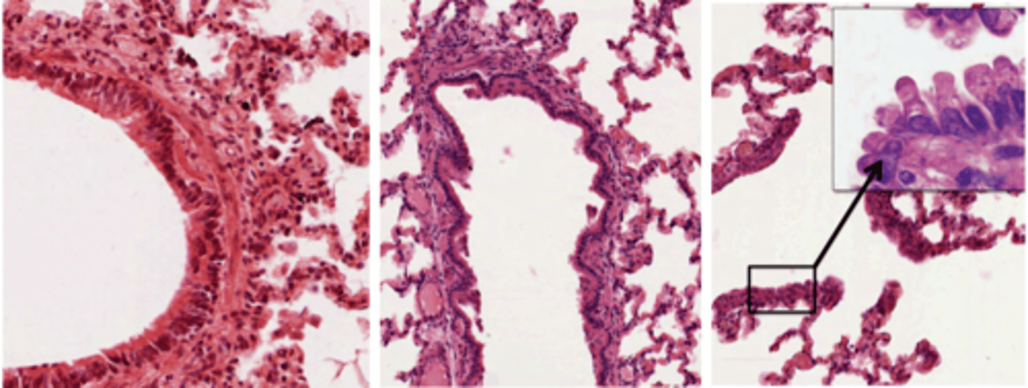 <p>Image I: bronchiole, with pseudostratified layer + smooth muscle; </p><p>Image II: terminal bronchiole, with some smooth muscle and cuboidal epithelium; </p><p>Image III: respiratory bronchiole, epithelium becomes thinner and lacks smooth muscle</p>