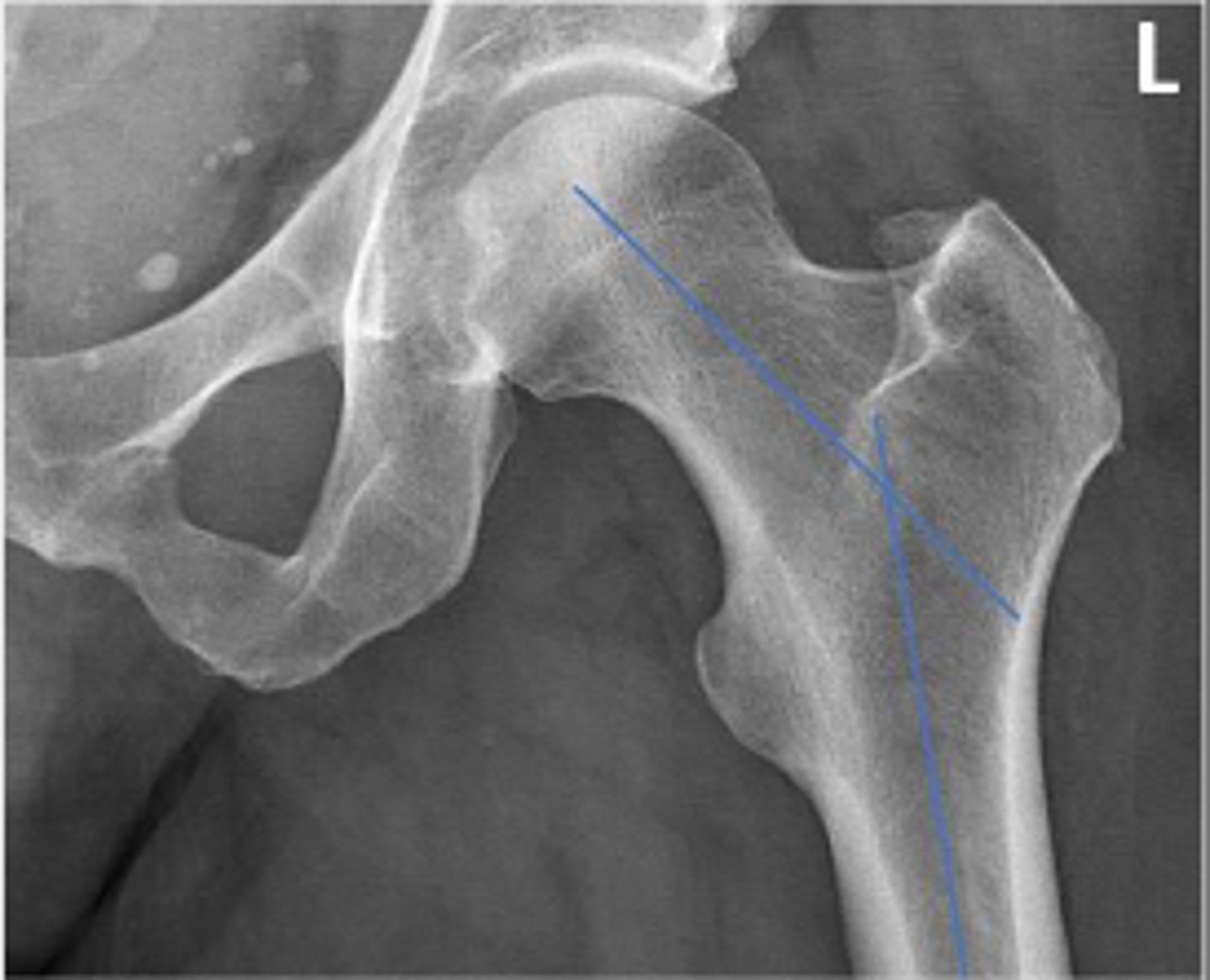 <p>What is the name of the assessment?</p>