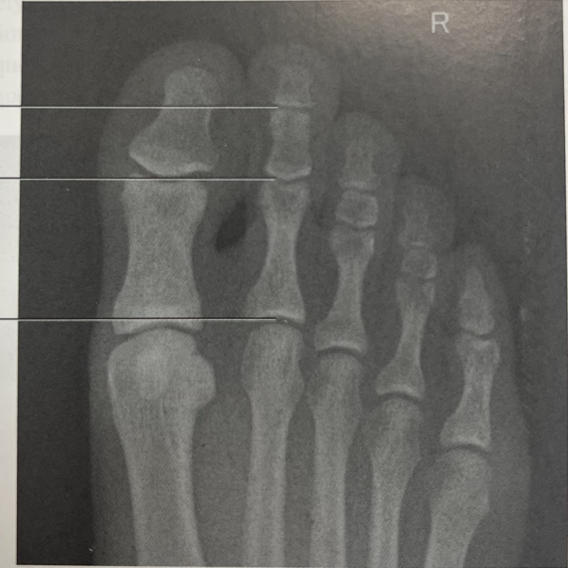 <p>identify the <strong>projection </strong>of the image </p>