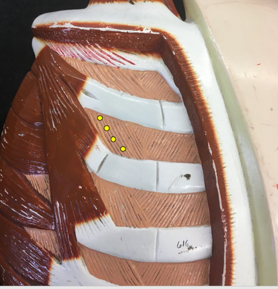 <p>Striations going to the exterior</p>